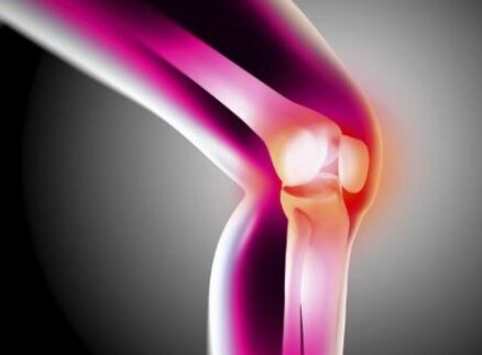 Deforming osteoarthritis