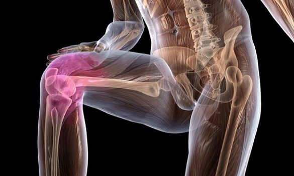 Signs and symptoms of the osteoarthritis of the knee joint