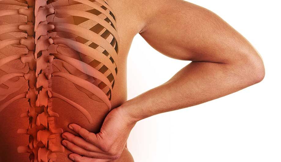 Osteochondrosis of the lumbar spine.
