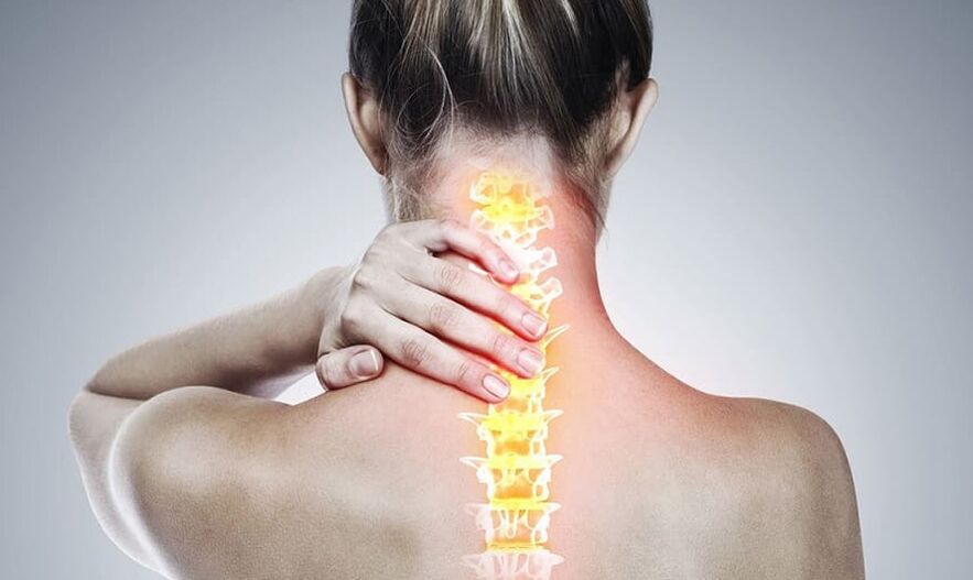 Osteochondrosis of the cervical spine.
