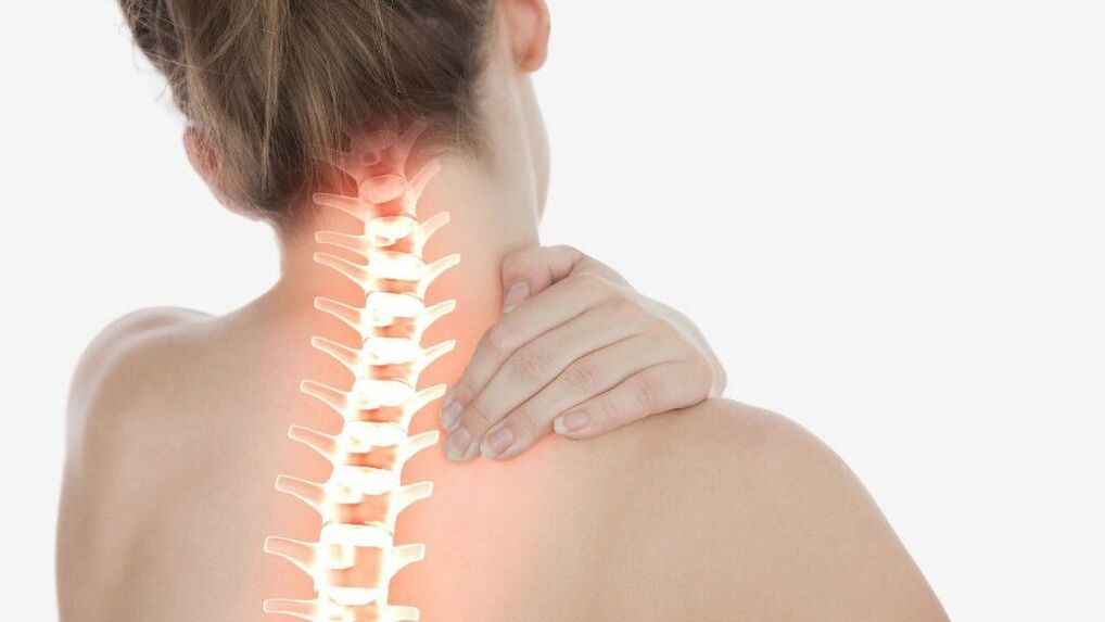 Neck pain due to osteochondrosis of the cervical spine.